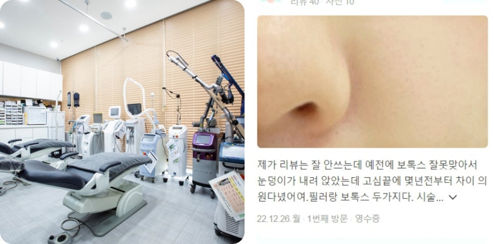 V라인 리프팅, 관련 이미지 17