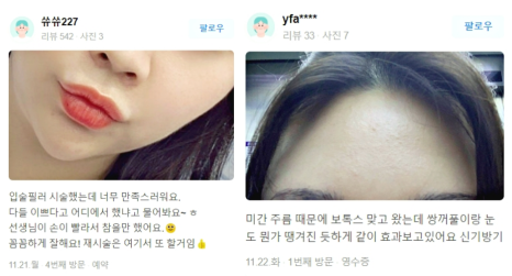 보톡스 필러 관련 이미지 13