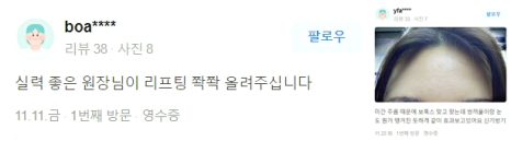 이마실리프팅으로 처진 눈 간단 해결! 관련 이미지 15