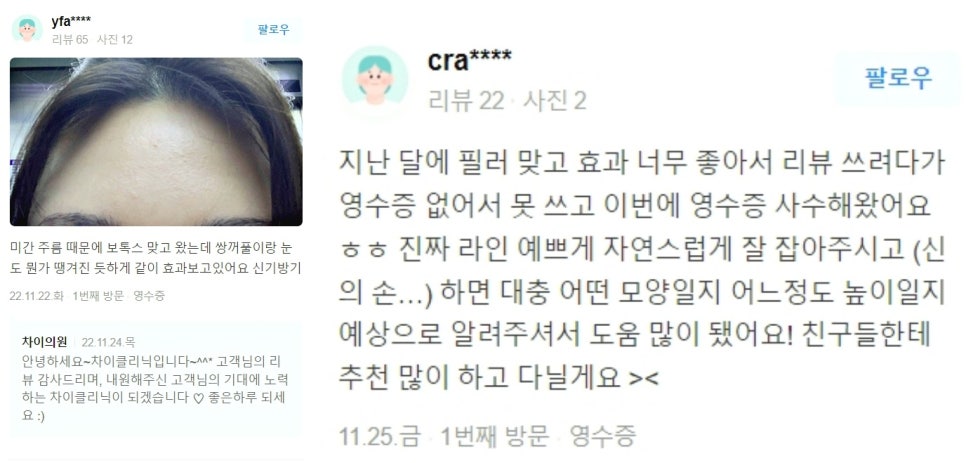 너무 많은 실리프팅종류와 효과, 이 글 하나로 정리해 드립니다. 관련 이미지 10