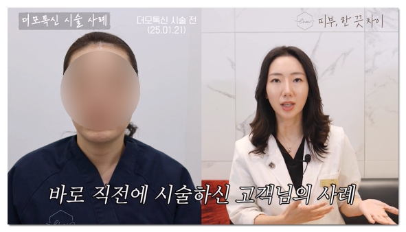 Mapo Botox: 3 Things to Check Before You Regret Getting It Cheap image 6