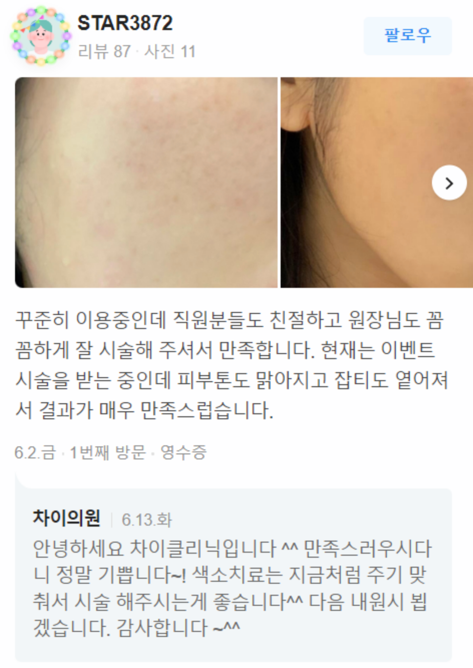 남자턱보톡스 OOO을 고려해야 관련 이미지 18