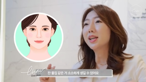 써마지FLX가격? 내 피부에 맞는 효과보는 법 관련 이미지 5