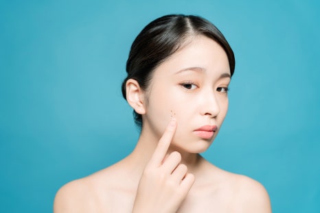 가좌역피부관리 여드름 흉터와 작별하는 방법 관련 이미지 2