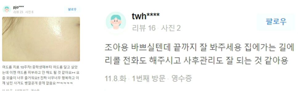 울써마지가격 주의사항까지 확실한 효과 보려면 관련 이미지 14