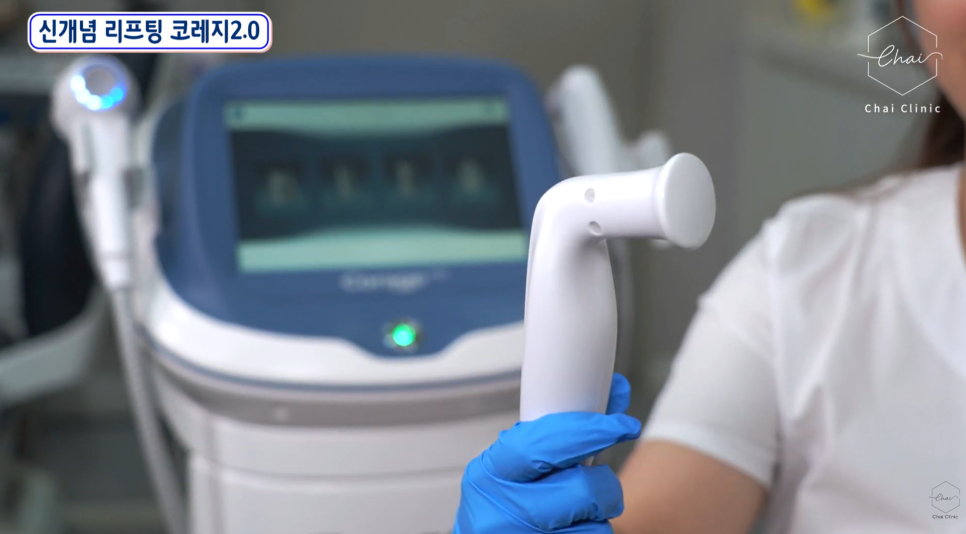 How to Achieve Thermage-Like Results with Corage Lifting image 9