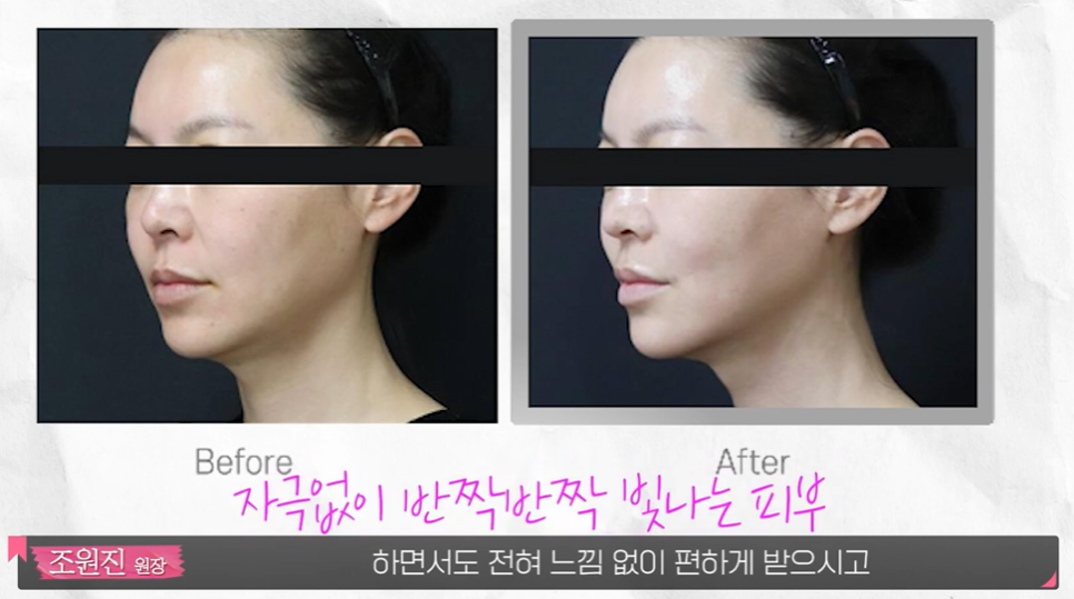 홍대 라라필 아쿠아필 차이 받기 전 알아야 할 3가지 관련 이미지 4