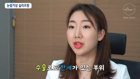 팔자주름리프팅 &lsquo;이것&rsquo;에 따라 효과가 달라져요 관련 이미지 6