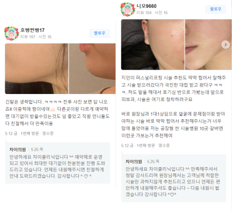 브이라인시술 매끄럽고 날렵한 라인으로! 관련 이미지 12