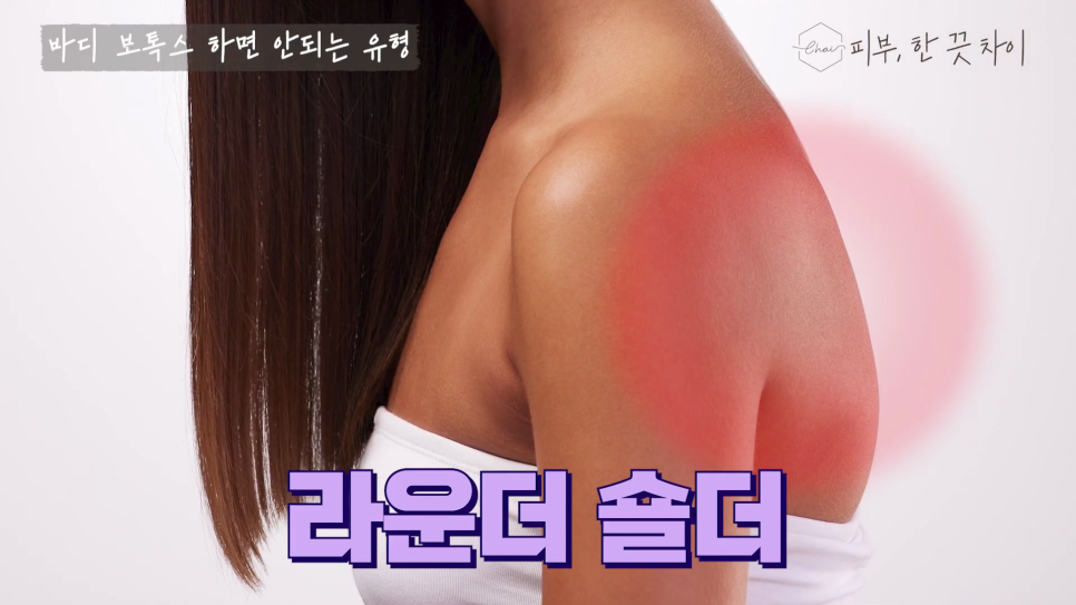 홍대보톡스, 관련 이미지 9