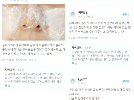 울트라V리프팅 날렵하고 굴욕 없는 셀카자신감! 관련 이미지 10