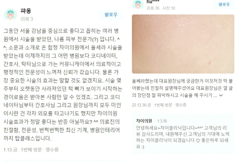 실루엣소프리프팅, 젊음의 생생함을 찾고 싶은 여러분에게 소개합니다. 관련 이미지 7