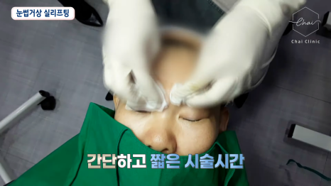 합정 블루다이아리프팅 비용, 5세대 실리프팅은 더 좋나요? 관련 이미지 8
