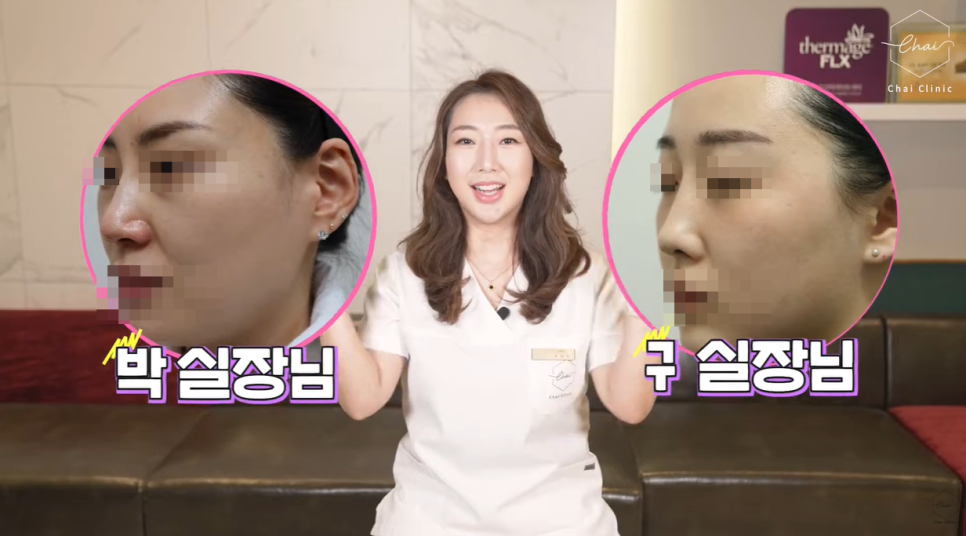 Hongdae Nose Filler Side Effects: Don’t Regret It — Get It Done Like This image 2