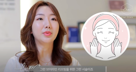 울쎄라 효과시기 제대로 보려면 &lsquo;이것&rsquo; 중요합니다 관련 이미지 8