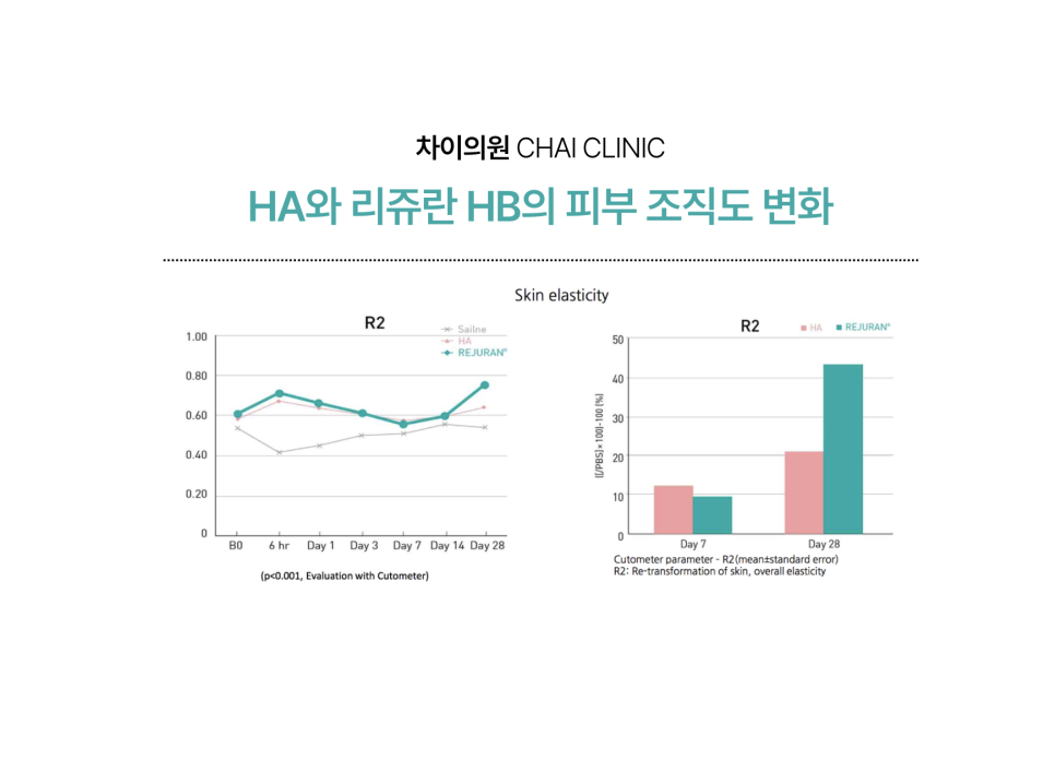 리쥬란 hb 후기에 대한 조원진 원장의 견해 관련 이미지 6
