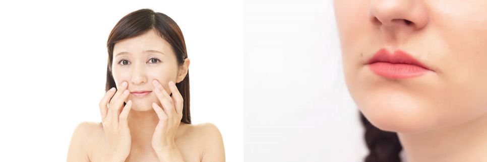 입가주름보톡스 알고 맞으면 효과 2배! 관련 이미지 4