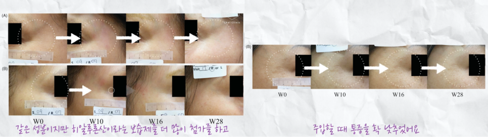 망원역피부관리, 리즈시절처럼 촉촉하게 관련 이미지 7