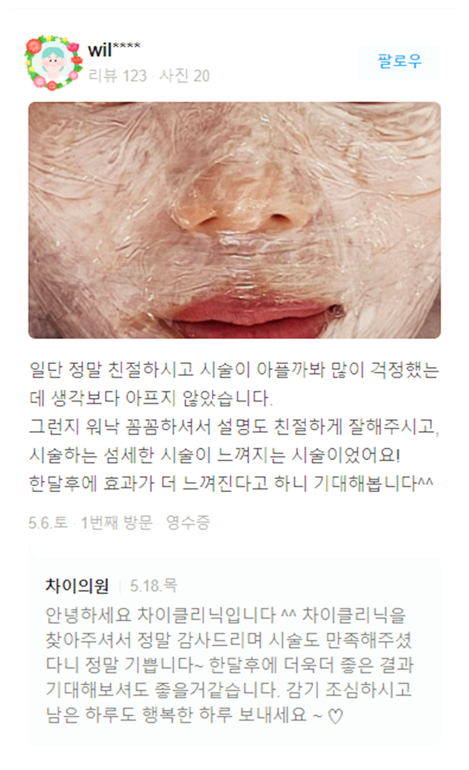아이슈링크 눈가 주름 없는 동안 피부로 관련 이미지 18