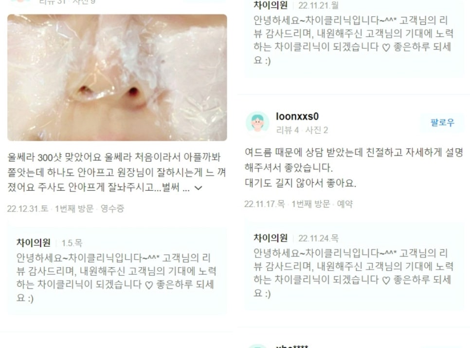 V라인 리프팅, 관련 이미지 12
