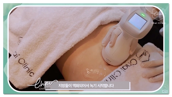 5 Things to Check Before Starting a Diet in Hapjeong image 3