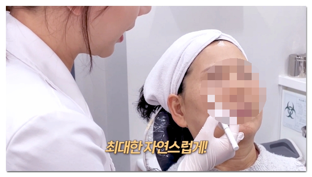 홍대 리투오 내얼굴에 효과 있을까? 효과 통증 총정리 관련 이미지 5