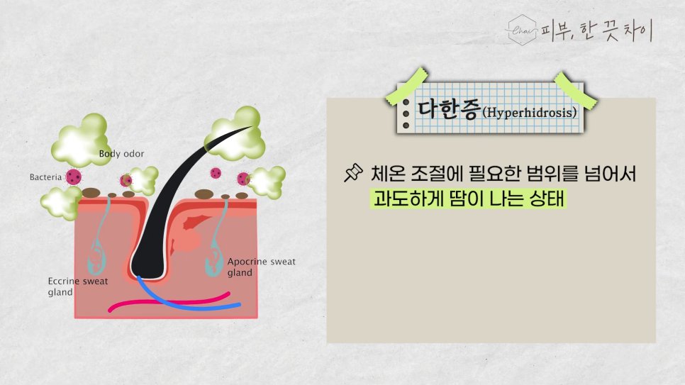 Hongdae Botox for Those Worried About Summer Hyperhidrosis image 7