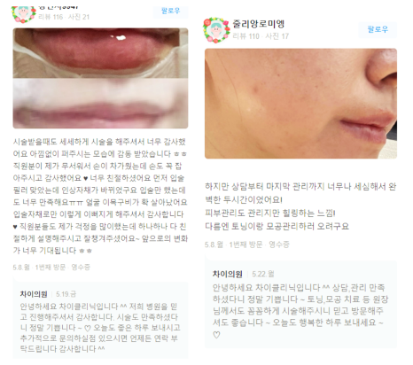 목리프팅 탄력저하 해결이 안 된다면 관련 이미지 14