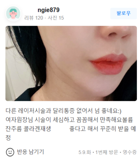 V라인리프팅 후기만 보고 결정하지 마세요! 관련 이미지 18