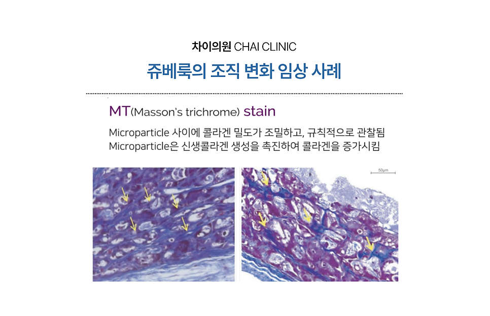 쥬베룩 효과 시기를 제대로 보기 위해선 관련 이미지 3
