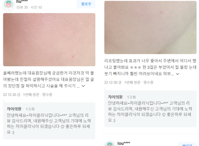 이중턱주사 맞기 전에 반드시 관련 이미지 14