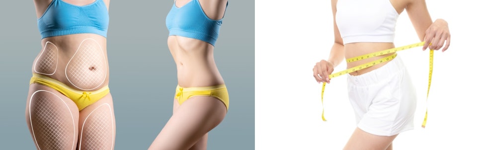 체지방분해주사 쉽고 빠르게 휴가철 비키니 몸매 완성! 관련 이미지 2