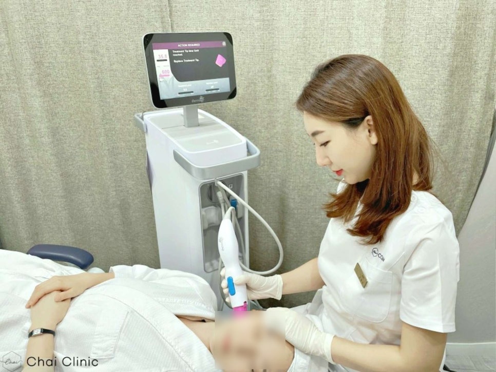 이마보톡스효과 밝아진 인상 어려 보여요 관련 이미지 6