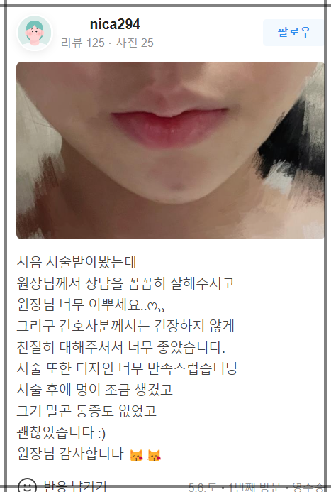 합정 입술필러잘하는곳 자연스러운 볼륨업을 원하시나요? 관련 이미지 17