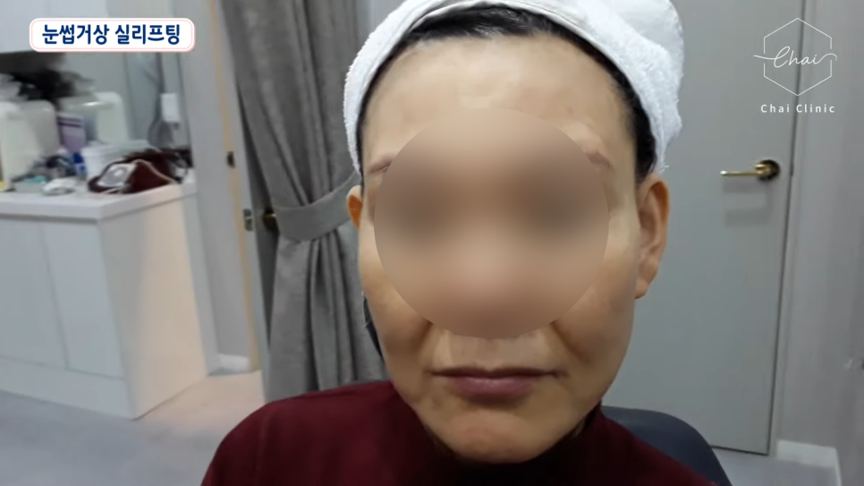 홍대 실리프팅 장점과 종류, 차이의원의 실리프팅 종류 함께 소개합니다. 관련 이미지 2