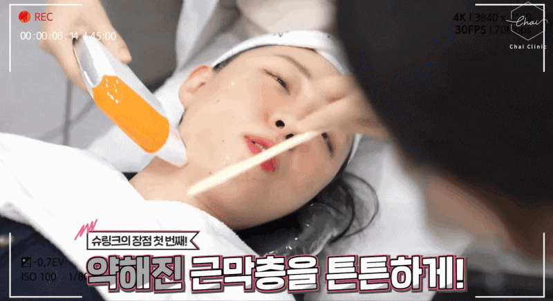 얼굴살시술 매끈하고 예쁜 라인으로 돌아가는 방법 관련 이미지 7