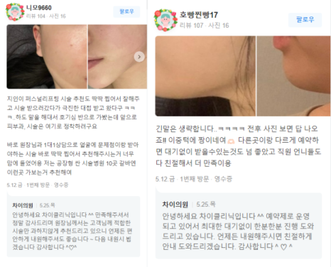 울쎄라팔자주름 울쎄라 실력자가 강조하는 &lsquo;이것&rsquo;! 관련 이미지 17