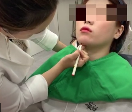 마포 필러 고민중이라면 하기 전에 꼭 읽어보고 진행해 주세요. 관련 이미지 3