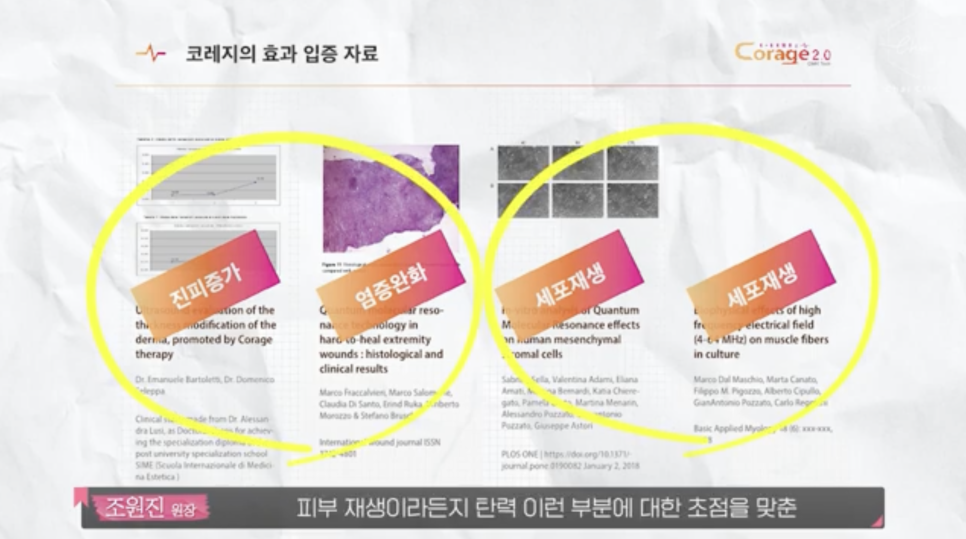 리쥬란 HB 통증에 대한 견해 관련 이미지 15
