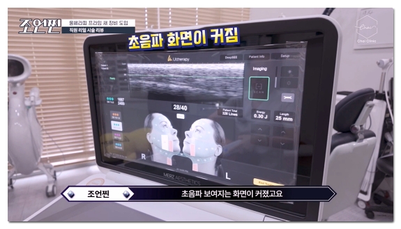 홍대 울쎄라 덜 아프고 효과 좋게 받는 방법 (수면마취 아님) 관련 이미지 3