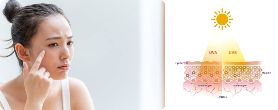 레이저토닝효과 제대로 보고 싶다면 ‘이것’ 중요합니다. 관련 이미지 4
