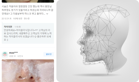 남자윤곽주사, 효과 제대로 보기 위해서는 ‘이것’이 필수! 관련 이미지 13