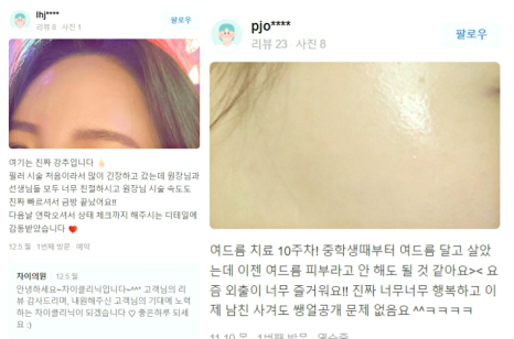 보톡스 필러 관련 이미지 15