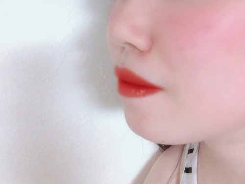 무턱주사로 돌출입 고민 해결할 수 있다? 관련 이미지 4