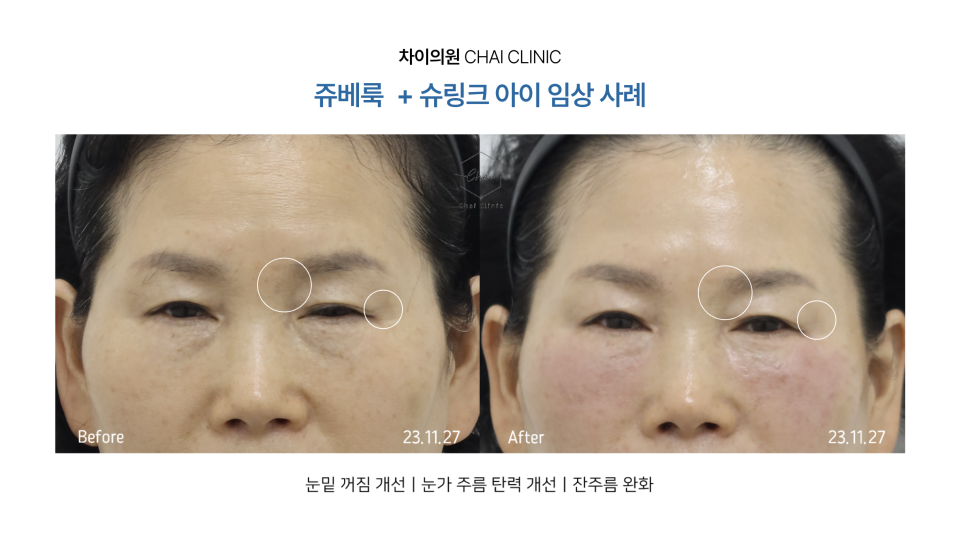 쥬베룩 성분에 따른 콜라겐 생성 촉진 효과 관련 이미지 10