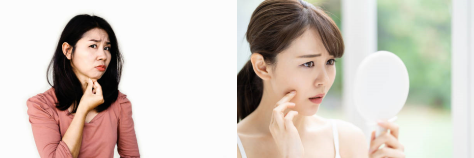 침샘보톡스가격 차이나는 이유와 효과, 진실 관련 이미지 13