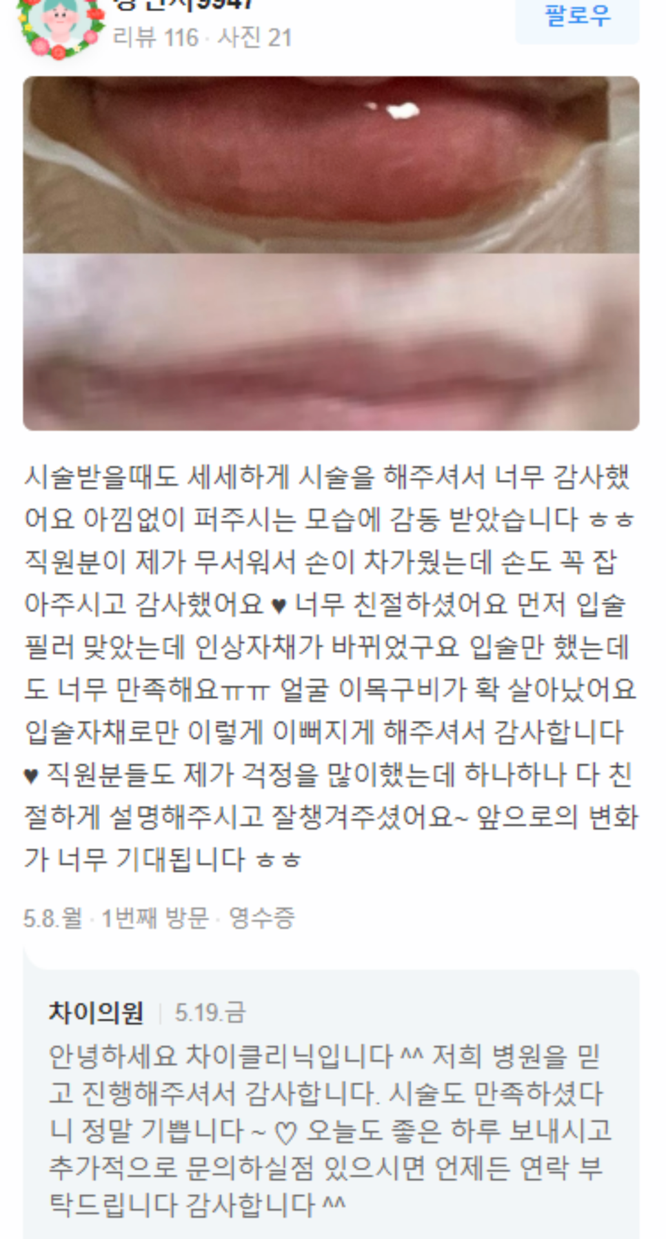 눈밑꺼짐필러로 볼륨UP과 동시에 다크서클까지 해결 관련 이미지 15