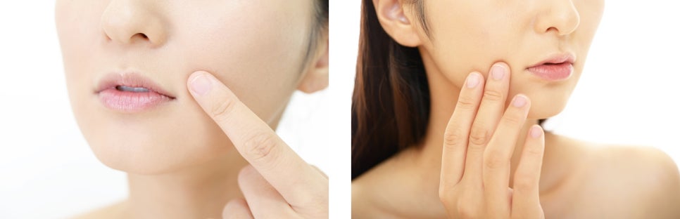 남가좌동피부관리 다양한 실리프팅 종류 관련 이미지 1
