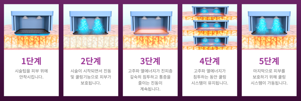 마포피부관리 잔주름 고민 해결하기(ft.근처 10분 거리) 관련 이미지 13
