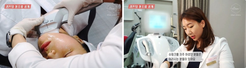 눈가 리프팅 탄력=기술력 어떻게 확인할까요?!😊 관련 이미지 5